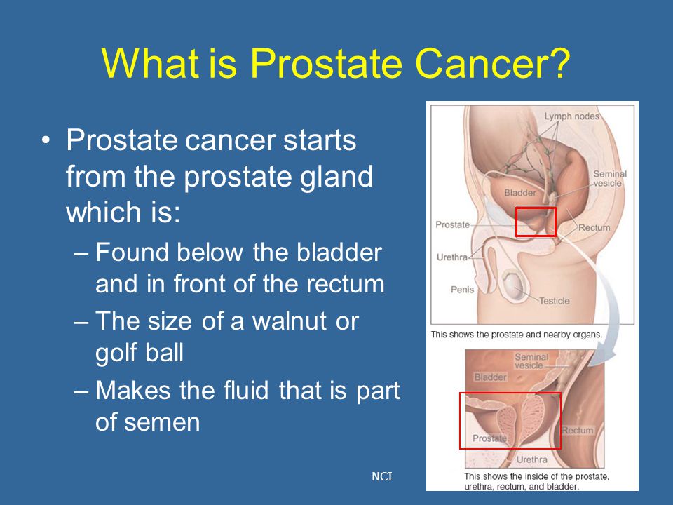 What can cause inflamed prostate